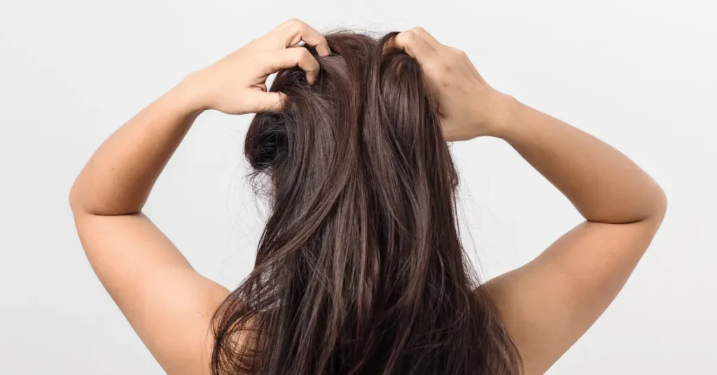 Κοπέλα ξίνει το τριχωτό της κεφαλής της λόγω ξηροδερμίας